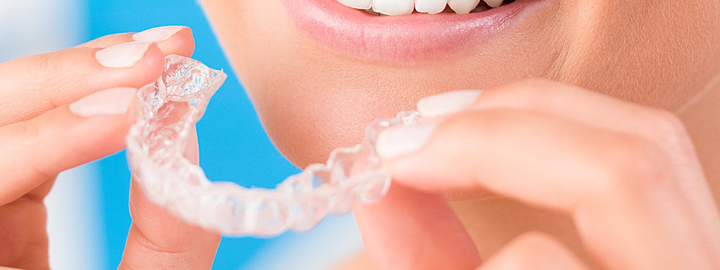 Durchsichtige Zahnschienen richtig reinigen
